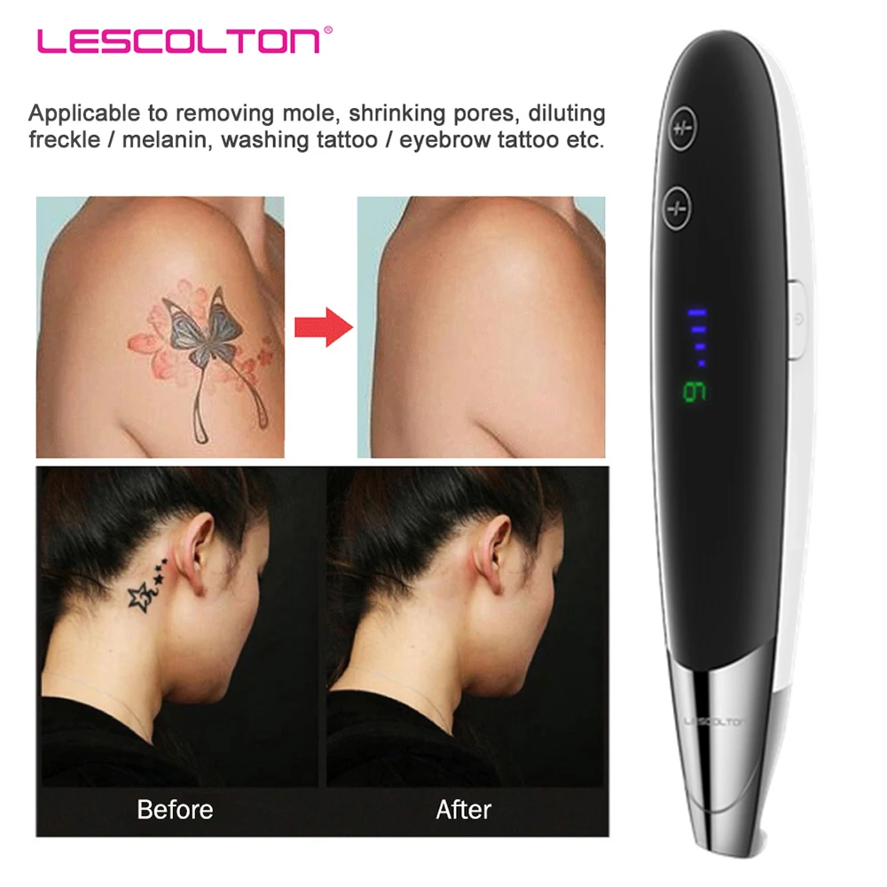 Лазерная пикосекундная ручка LESCOLTON средство для удаления татуировок светильник