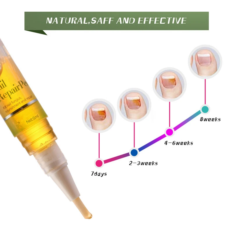 LANBENA 1 шт. грибковая ручка для лечения Ногтей паронихикоз инфекция ногтей