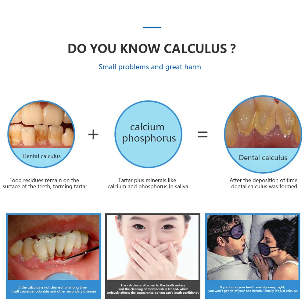 Usb Перезаряжаемый зубной скалер для чистки зубов|Ирригаторы полости рта| |