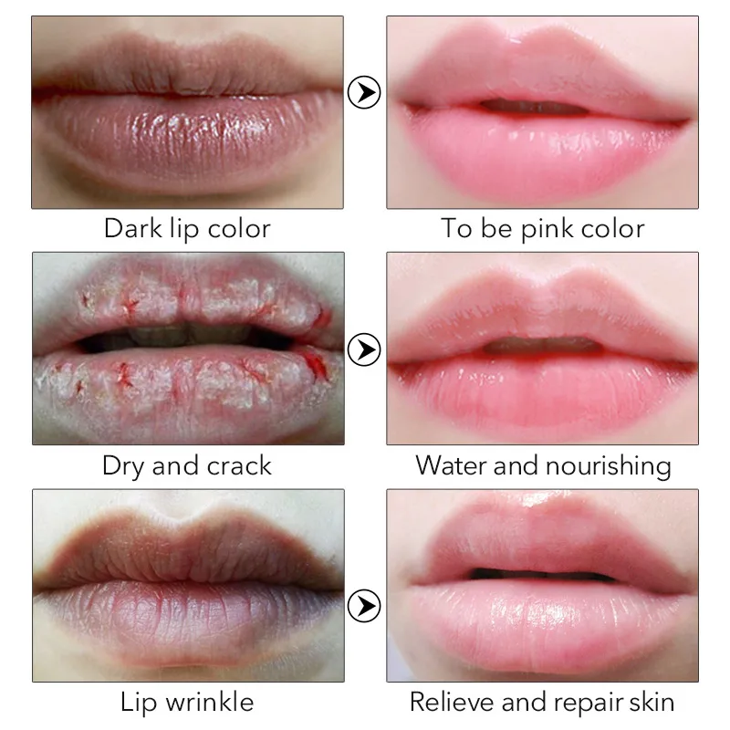 Бальзам для губ Daralis медовый увлажняющий бальзам 3 5 г улучшения восстановления