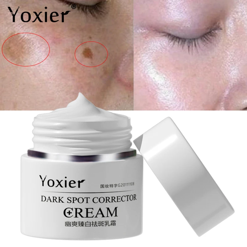 

Dark Spot Correction Cream Remove Spots Body Pigmentation Face Cream Uneven Skin Tone Whitening Brightening Skin Care 30g