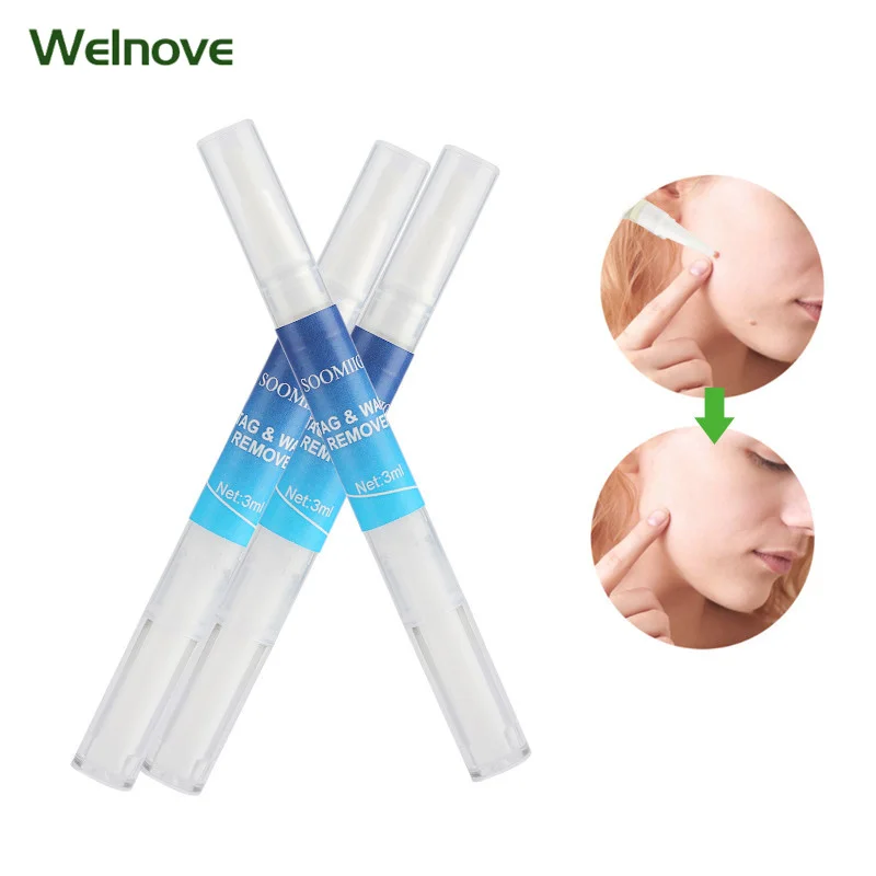 

3ml Black Dots Mole Wart Skin Tag Remover Liquid Medical Corn Removal Foot Genital Care Mole Removal Papillomas Treatment
