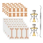 1 Набор, фиксатор для коррекции вросших ногтей