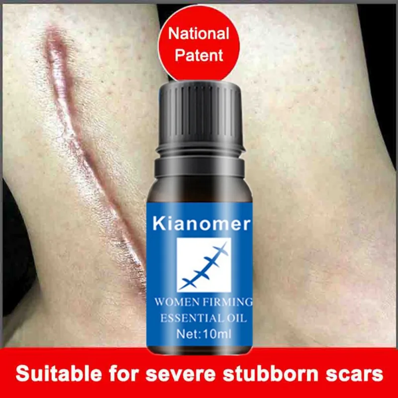 

Effective!Scars Removal Oil Nourishing Skin Lightening Pigment Acne Marks Scars Remover Creams & Moisturizers HOT