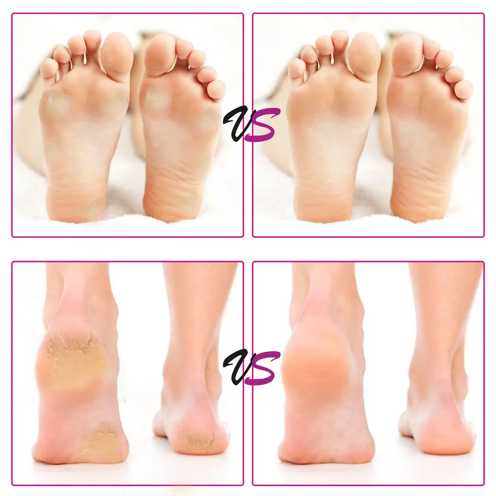 Электрический аппарат для педикюра инструмент ухода за ногами удаления