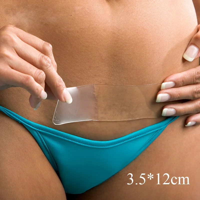 Стрейч Знаки и лечение шрамов стрейч для беременных уход за кожей тела Красота