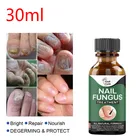 Быстрое лечение грибков на ногтях, эссенция для восстановления ногтей, для ухода за ногтями, для удаления грибка на ногтях, гель для паронихии и онихомикоза TSLM3