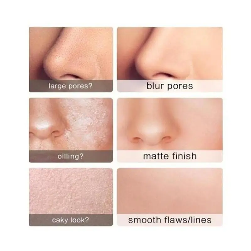 30 мл кислота анти удалить парк Спрингс аккор Pretty/кожу гиалуроновой витамин уход