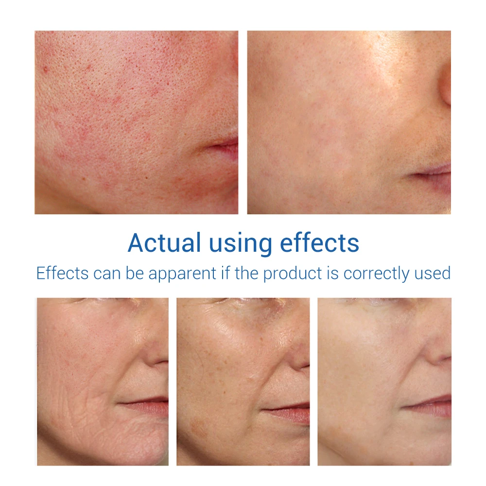 Гиалуроновая кислота Сыворотки 40 мл разглаживает мелкие морщинки увлажняющая