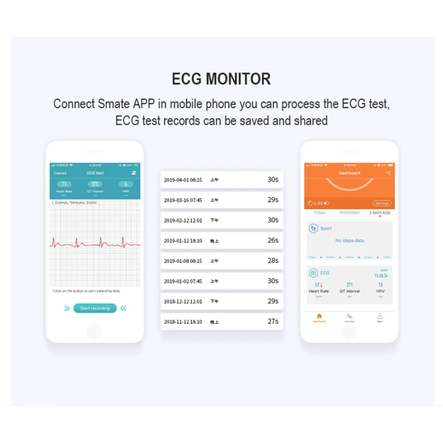 Перезаряжаемый портативный ручной Bluetooth-монитор ЭКГ 24 часа электрокардиограмма