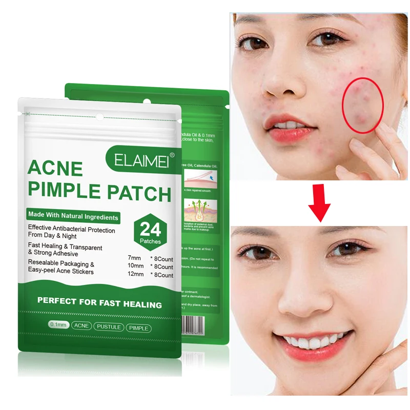 Наклейка для удаления акне против наклейка лечения черных точек маска ухода за