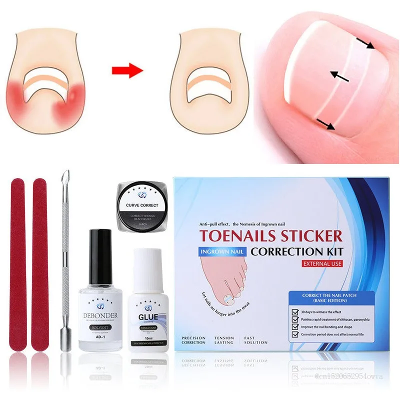 5 в 1 Набор для ухода за ногами вросшие ногти корректор с подарки носок фиксатор