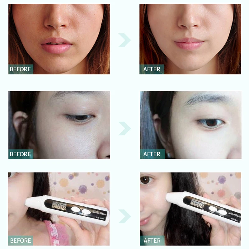 150 мл лицо улитки моющее средство контроль выработки кожного жира Очищающие