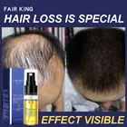 Питательная эссенция чайного дерева для роста волос, лечение, предотвращение выпадения волос, масло для поддержания упругости, уход за волосами, делает волосы более гладкими