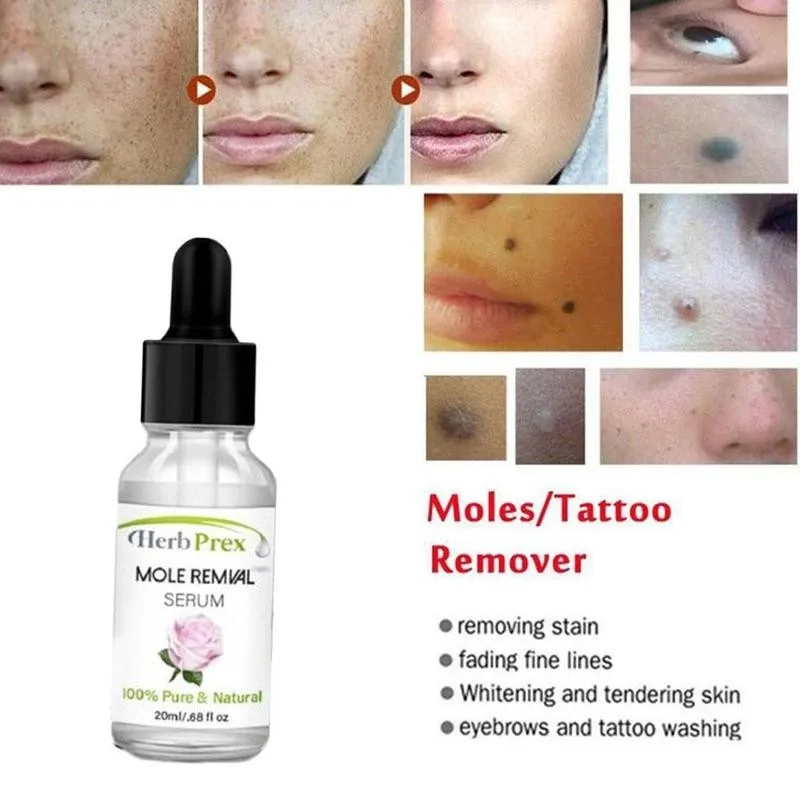 

No Trace Mole Removal Cream Essential Oil 20ml Organic Tags Solutions Serum Skin Tag Mole Freckle Spot Fast Remover Skin Care