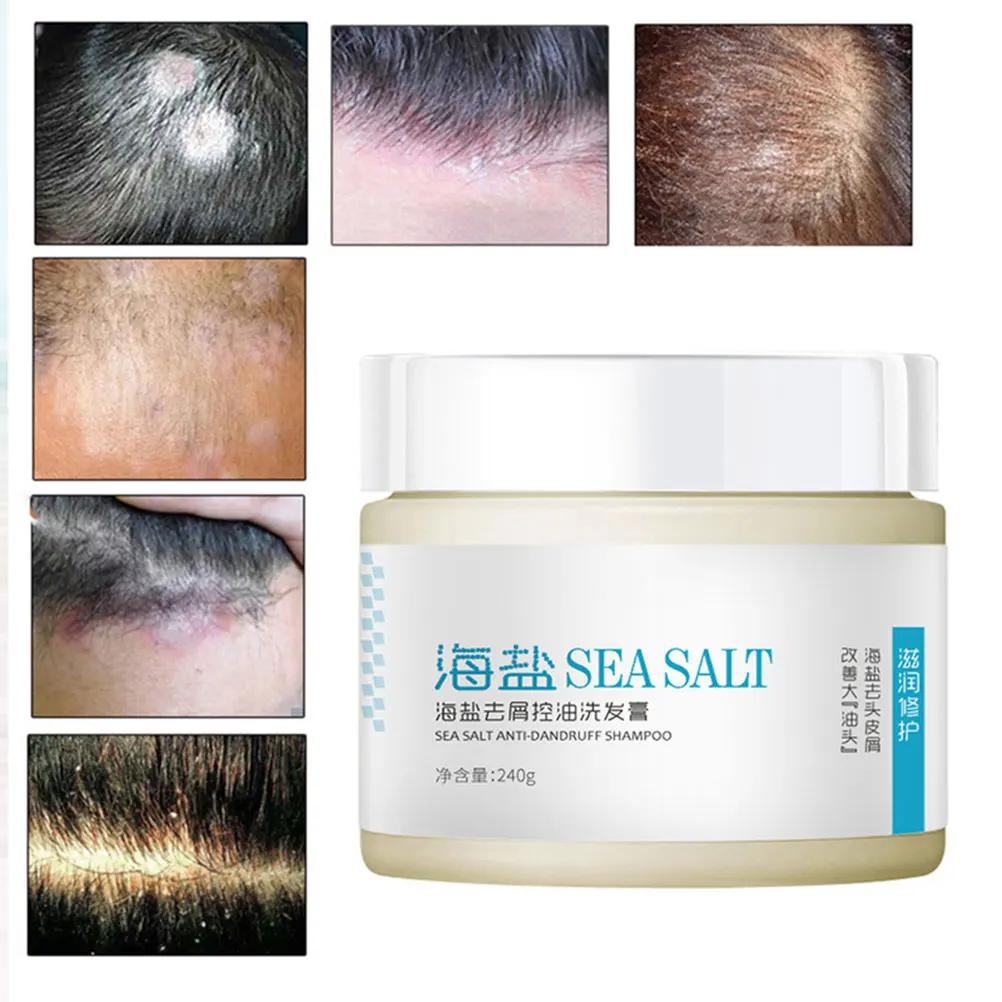 Шампунь против перхоти 240 г контроль жирности морской соли устранение зуда