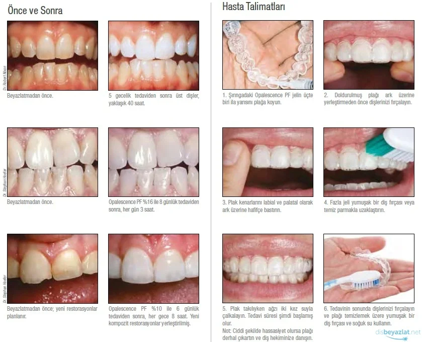 Профессиональные домашние полоски для отбеливания зубов ультратонкая