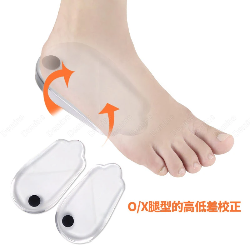 Силиконовая Магнитная терапия ортопедические стельки для O/X образную кривизну