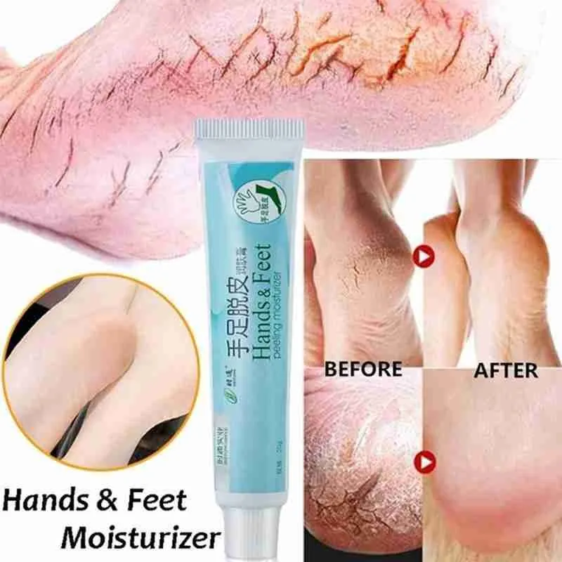 

Foot Hand Body Cream Hydrates Severely Dry Skin Peeling Moisturizing for Hand and Foot Moisturizer