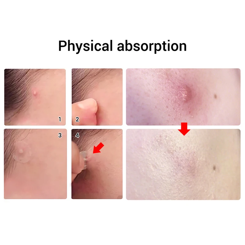 Маска для удаления черных точек LANBENA маска средство ухода за кожей лица | Красота