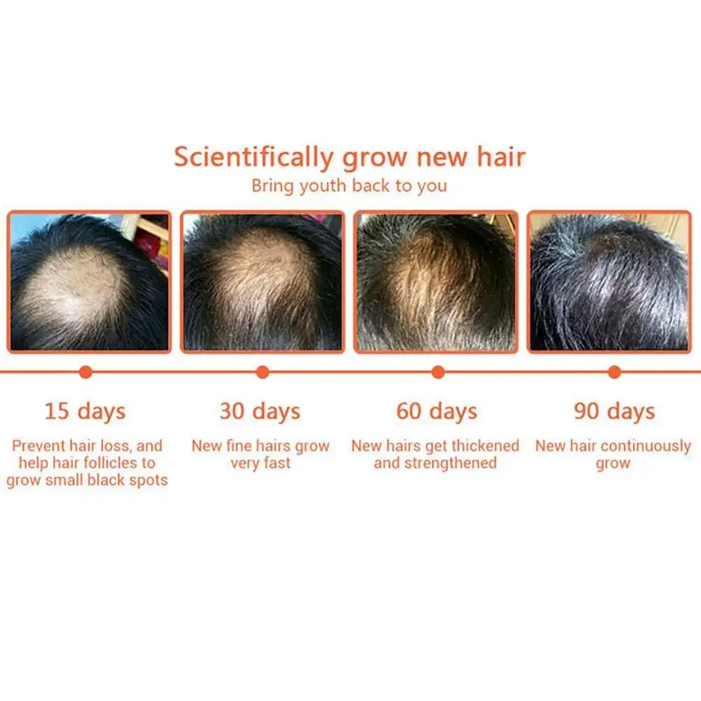 Hair Growth Loss Liquid 20ml Dense 1 Bottle Fast Organic Grow Restoration Pilatory | Красота и здоровье