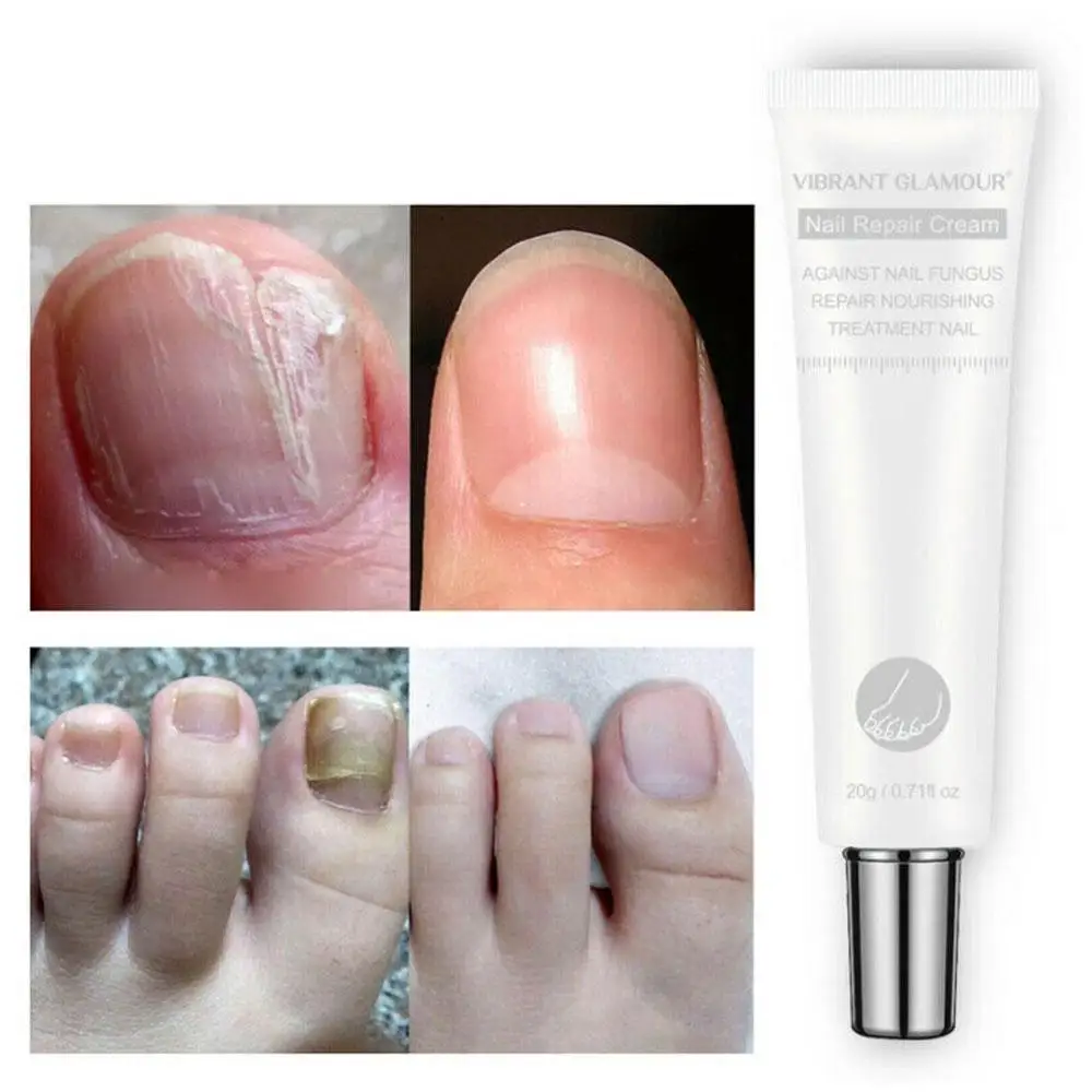 

Nail Care Nail Repair Cream Nail Treatment Nail repair cream V8B2