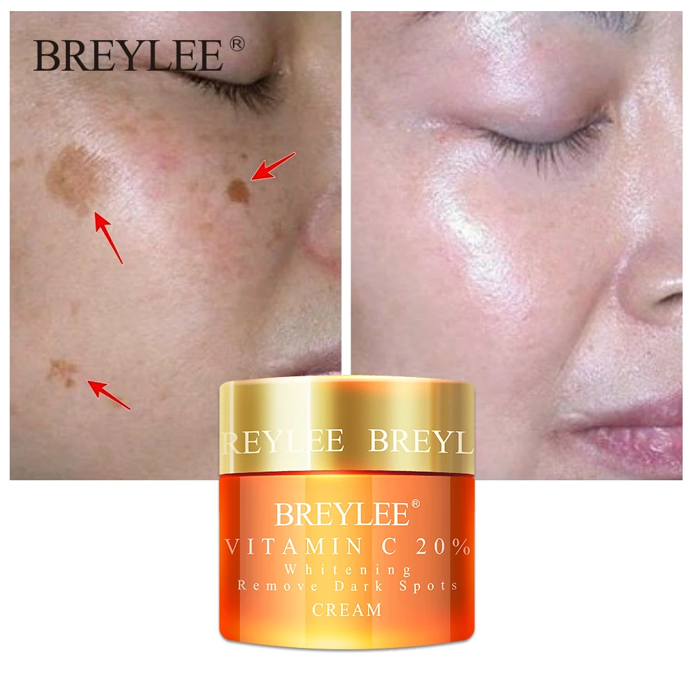 

Breylee Vitamin C 20% Vc Whitening Facial Cream Repair Fade Freckles Remove Dark Spots Melanin Remover Brightening Face Care