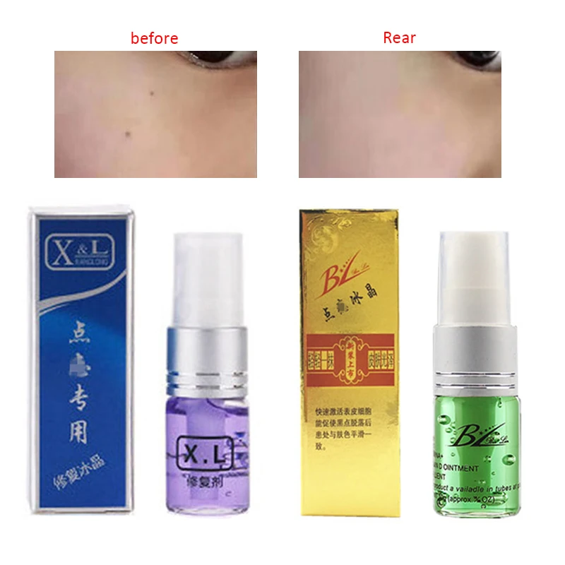 Professional Mole Removal Cream Facial Freckle Wart Tag Face Care Repair Solution Painless TSLM2 |