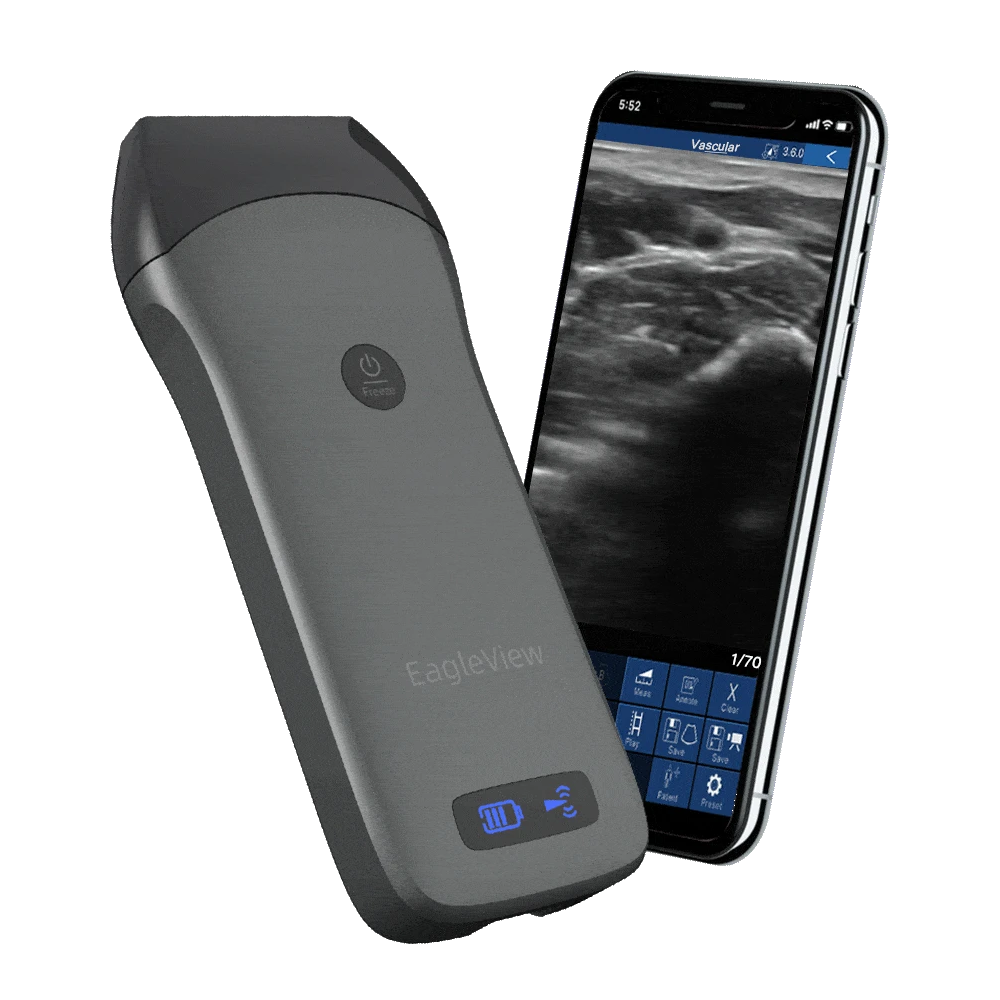 Portable Wireless Ultrasound Scanner Gel Vascular Therapeutic Handheld Machine Linear Wireless USB Rehabilitation Physiotherapy