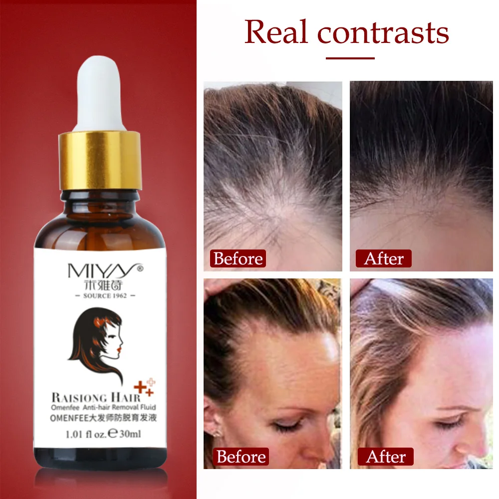 Быстрое наращивание волос эссенция масло против алопеции лечение помогает