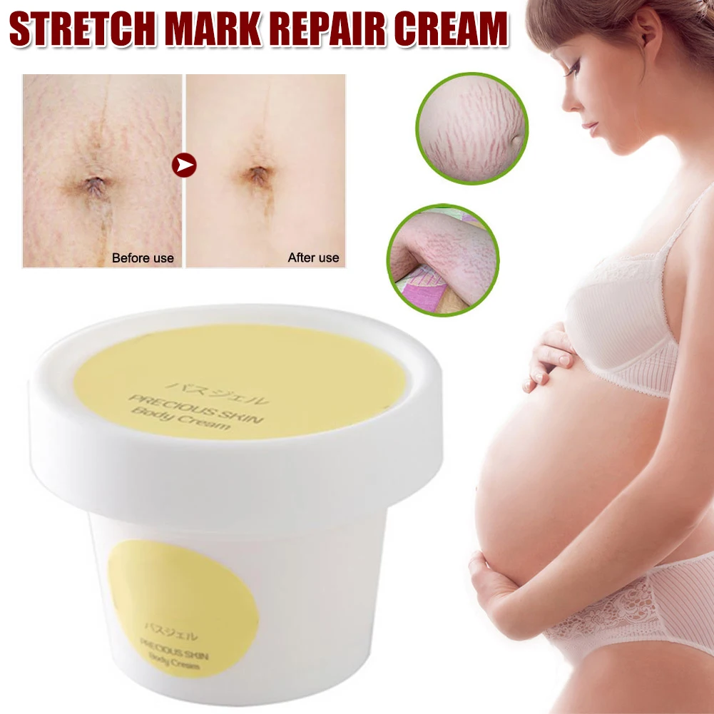 

Stretch Mark Cream Scar Cream Repair Anti-Aging Anti-Winkles Firming Body Creams for Pregnancy Health99
