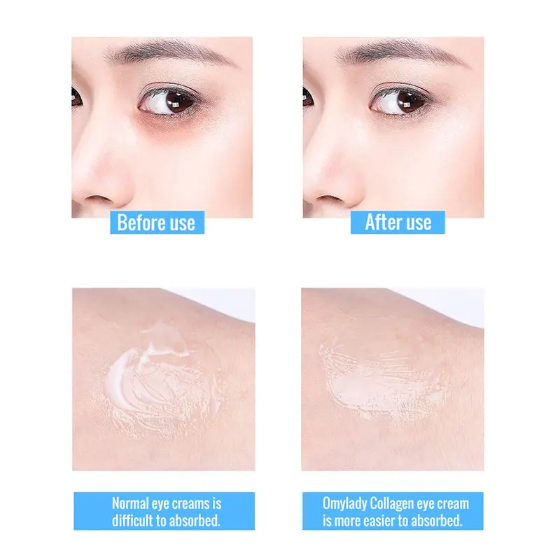 

Eye cream-anti-wrinkle cream, anti-aging, remove puffy bags under the eyes, compact moisturizing whitening, Collagen eye essence