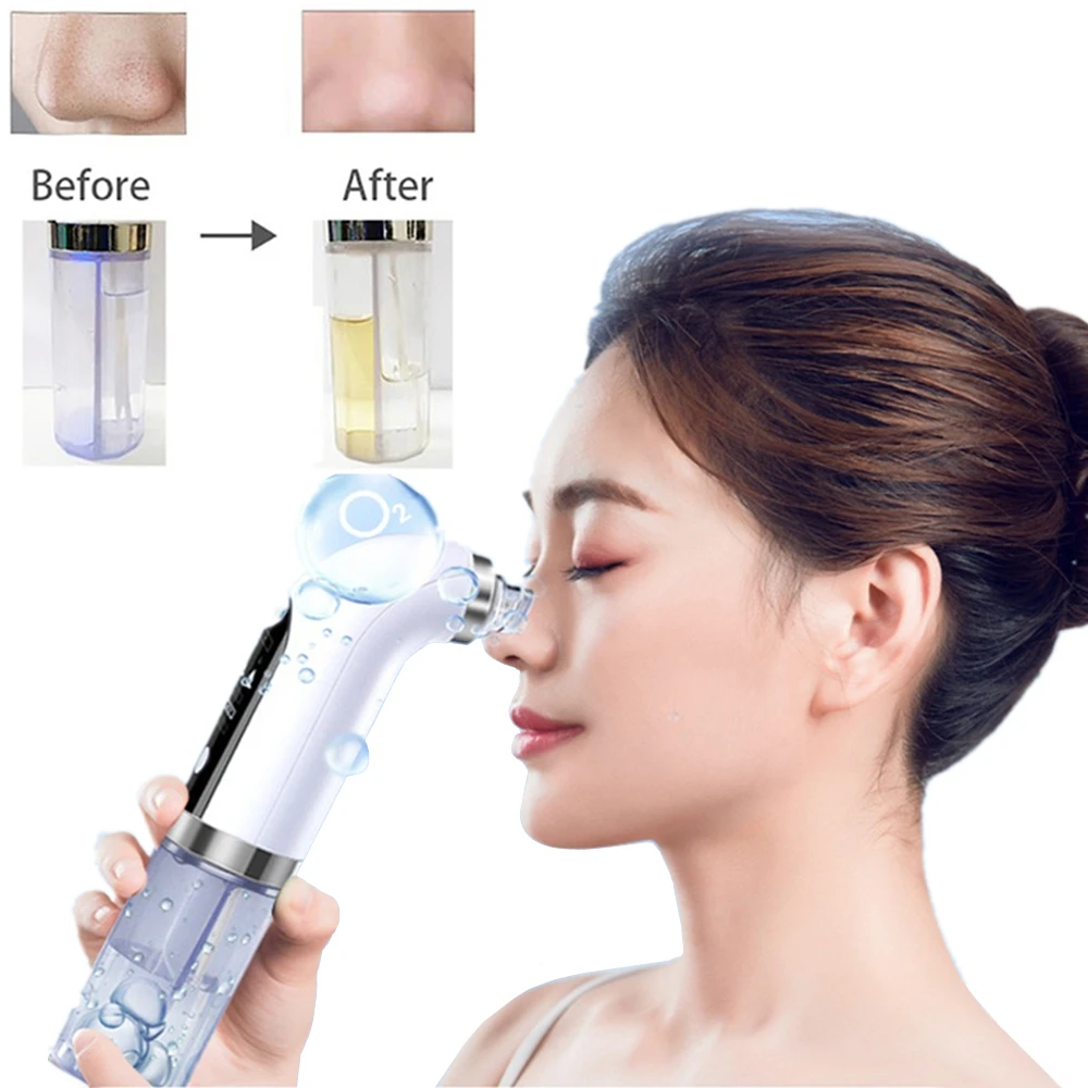 

Electric Blackhead Remover Pore Vacuum Suction Facial Cleaner Rechargeable Water Cycle Pimple Removal Acne Extractor Tool