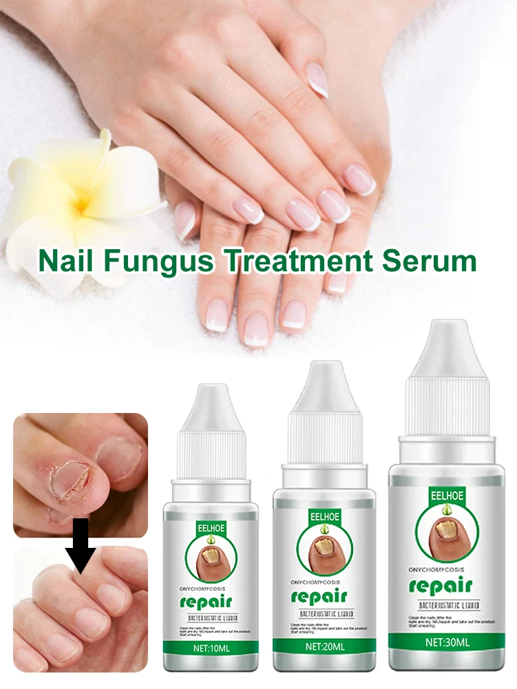 10мл/20мл/30мл Сыворотка для лечения грибка ногтей, восстановления ногтей, стимулирования роста и укрепления треснувших ногтей.