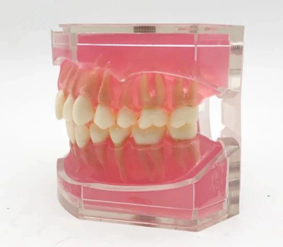 

Dental teeth model study teach standard model with removable teeth