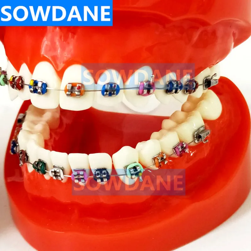 Стоматологическая Ортодонтическая обучающая модель с ортодонтическим