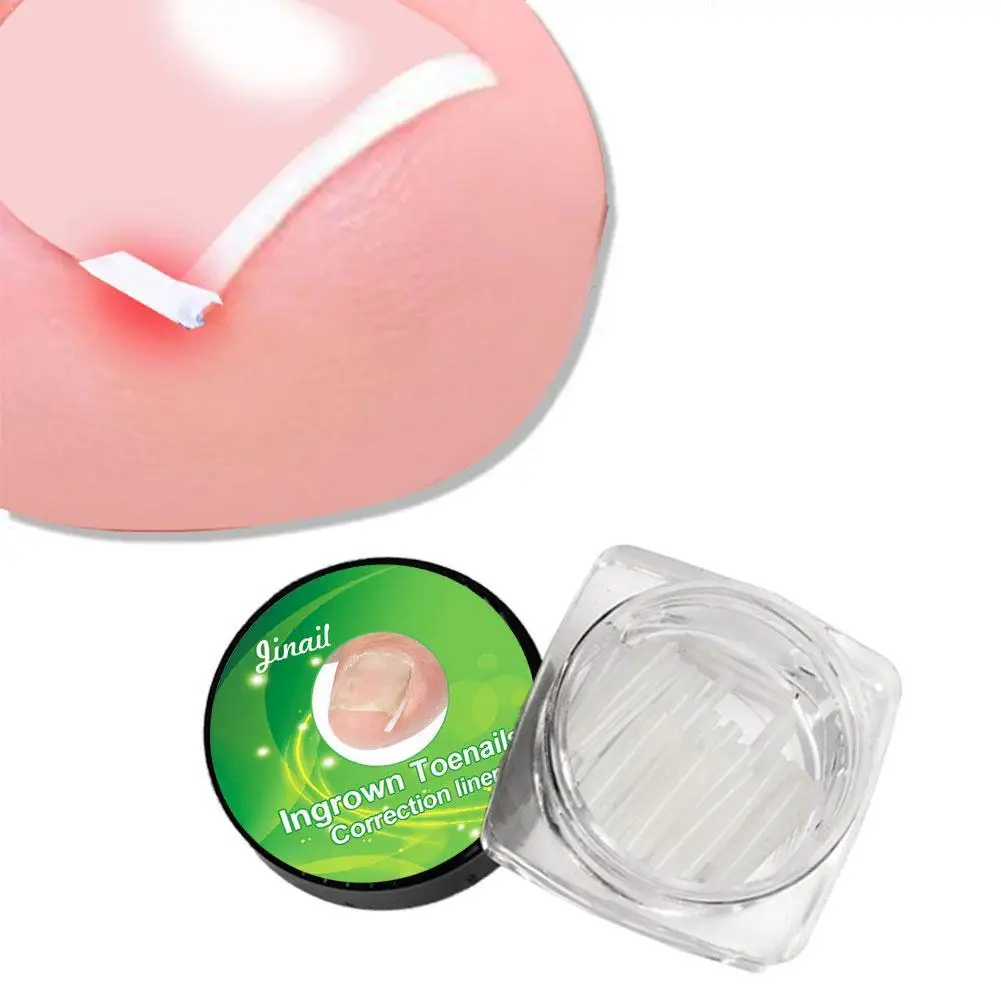 

1PC Ingrown Toe Nail Recover Tool Pedicure Toenail Care Ingrowing Nail Corrector For Toes Nail Bunion Foot Pedicure Fixer R1C8
