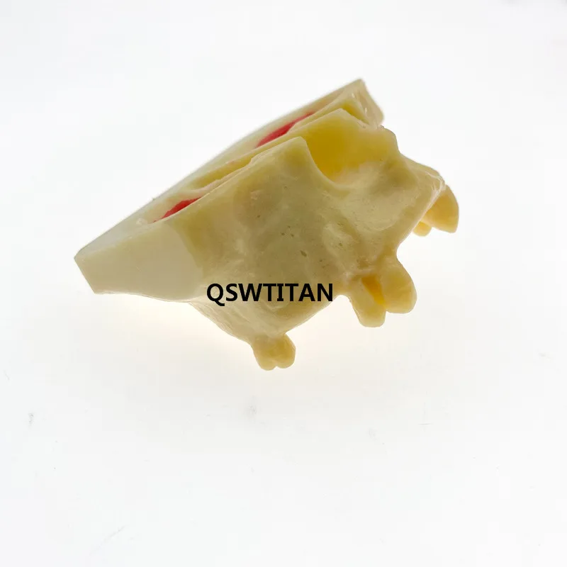 Стоматологическая модель зубов для тренировок при подъеме Модель обучения