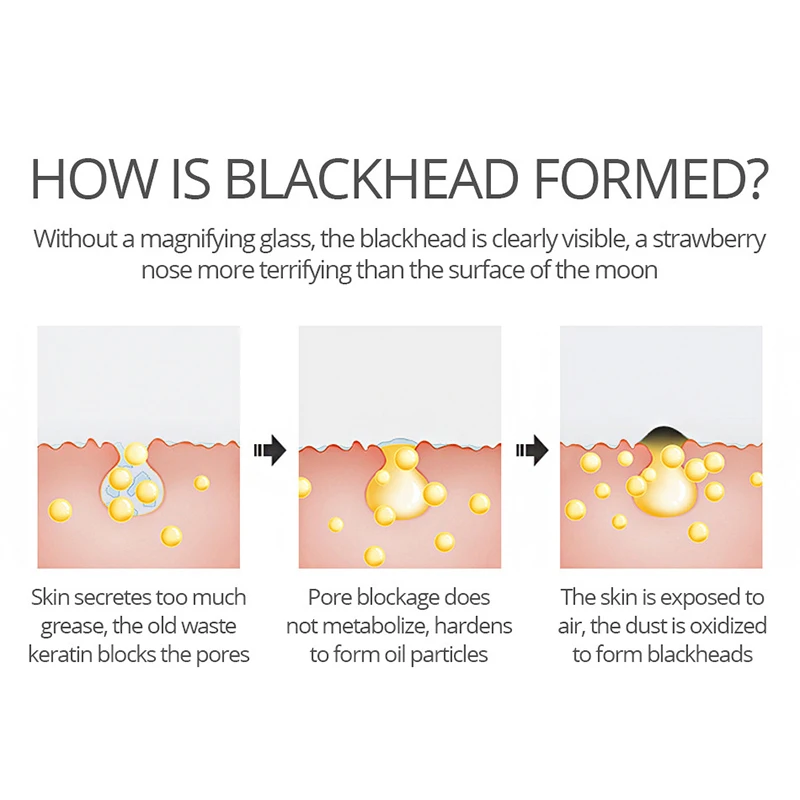 

Gentle Bamboo Charcoal Mask Blackheads Removal Deep Pore Cleanser Skin Care M88