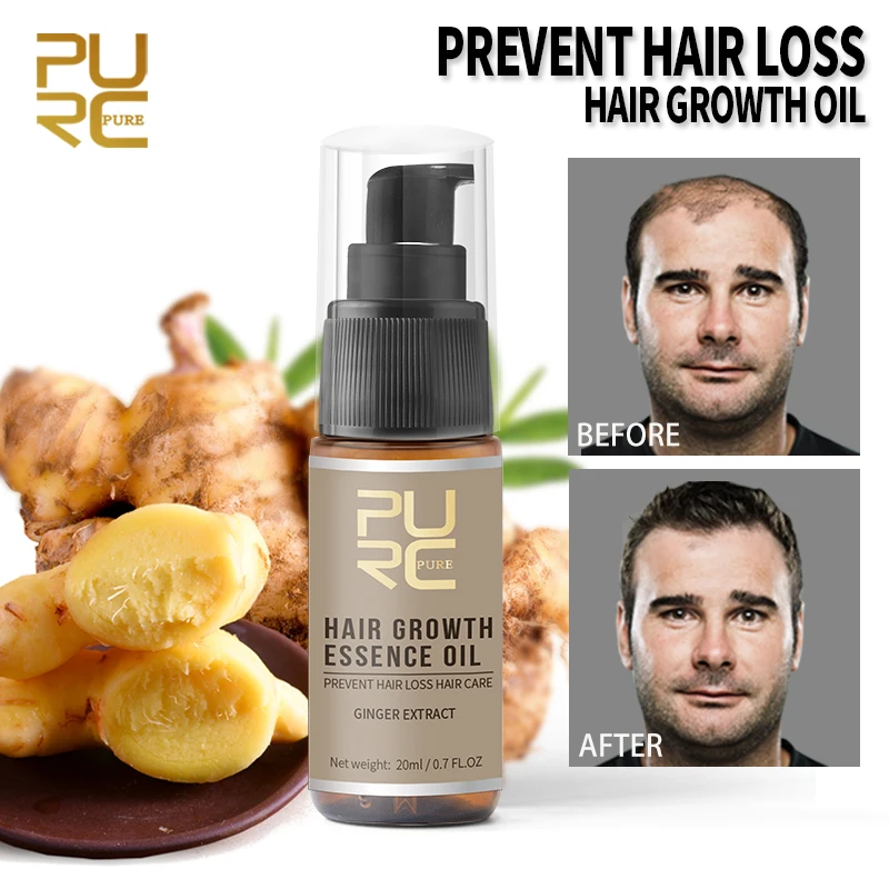 

PURC Hair Growth Essence Oil Ginger Essential Liquid for Hair Loss Treatment Thickener Strengthen Regrowth Hair and Scalp Care