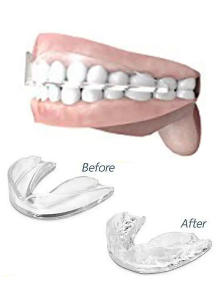 Горячая Распродажа 2019 защита для зубов от грубости против храпа сна анти