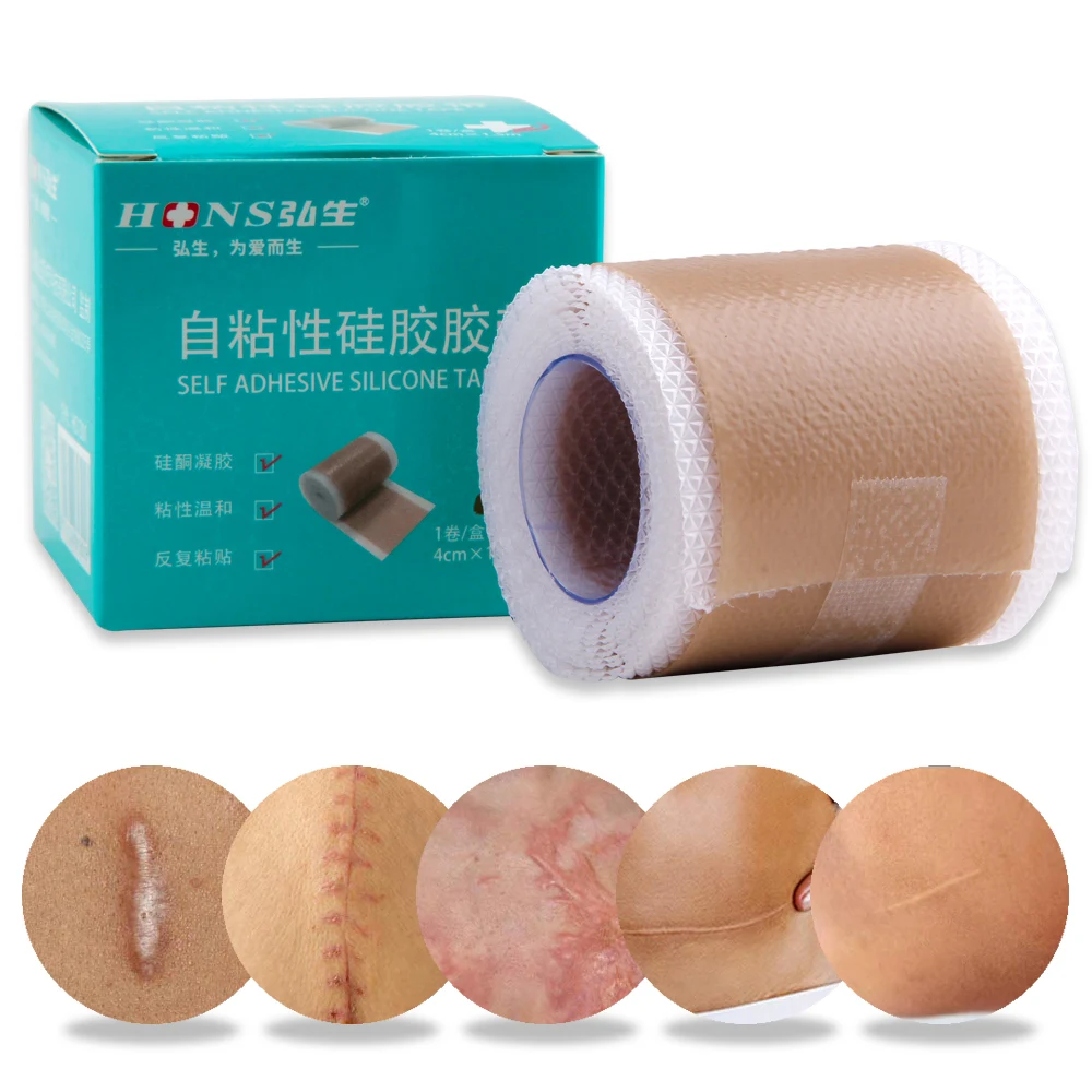 4x50cm Silicone Scars Patch Wounds Band Remove Acne Burn Scar Treatment Cover Ear Correctors Efficient Repair Damaged Skin Sheet