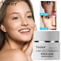 face cream remove dark spots age spots chloasma moisturizing lighten pigmentation whitening deep nourishment repair face care