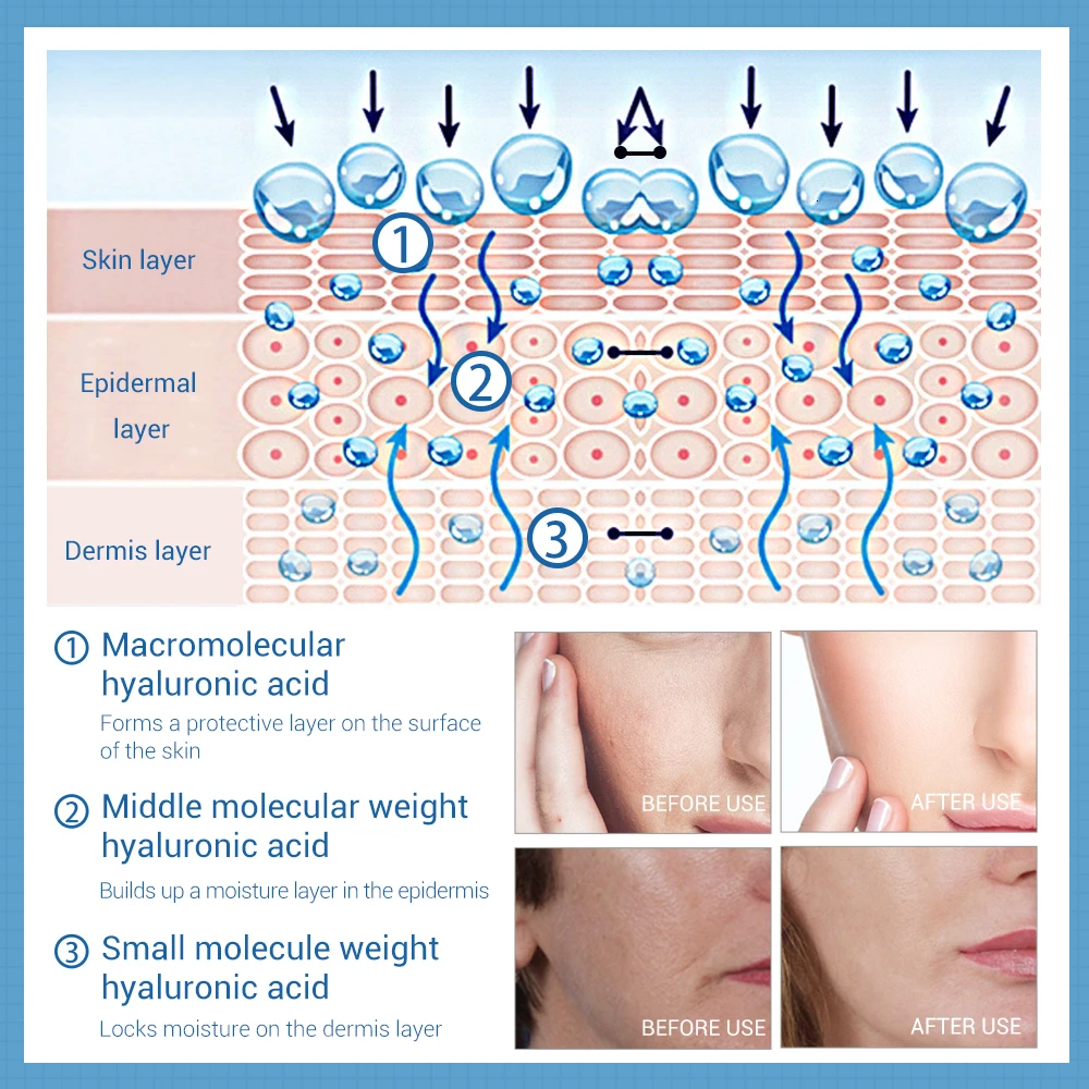 Гиалуроновая кислота Сыворотки 40 мл разглаживает мелкие морщинки увлажняющая