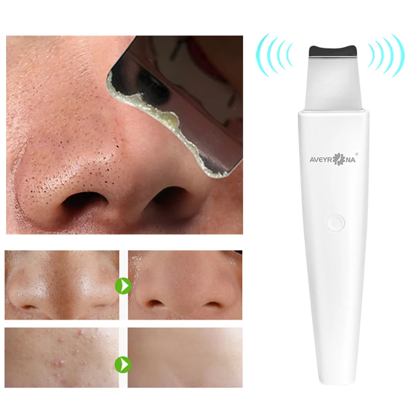Ультразвуковой очиститель кожи лица анион скребок для очистки пор пилинг Лопата