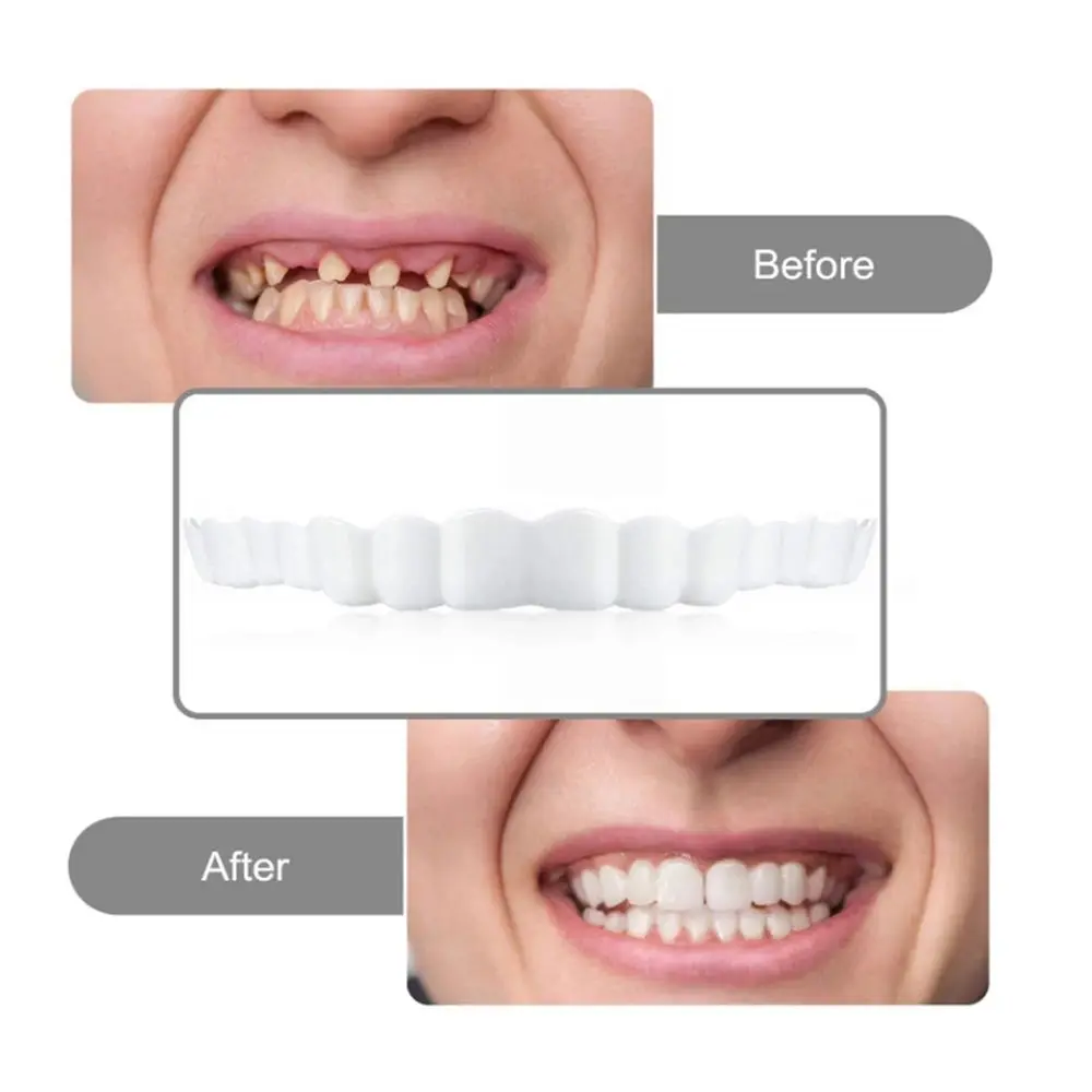 Upper Lower Fake Tooth Kit Veneers Teeth Temporary False Cover Denture Braces Perfect Smile Cosmetic Dental Tool | Красота и здоровье