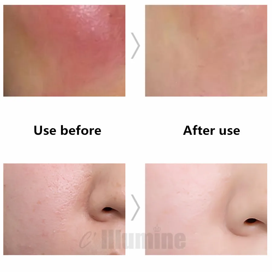 Рисунок 5 - Высококлассное керамическое решение