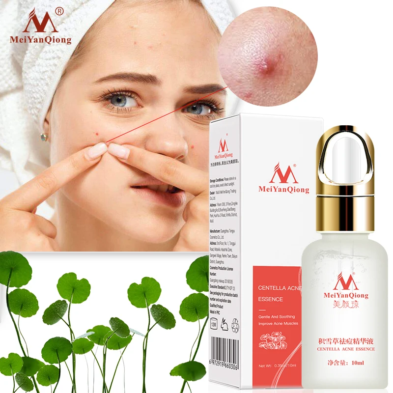 

Centella Asiatica Acne Removing Essence face Serum liquid Moisturizing Anti Wrinkle Shrink Pore Control Oil Whiten Skin 10ml