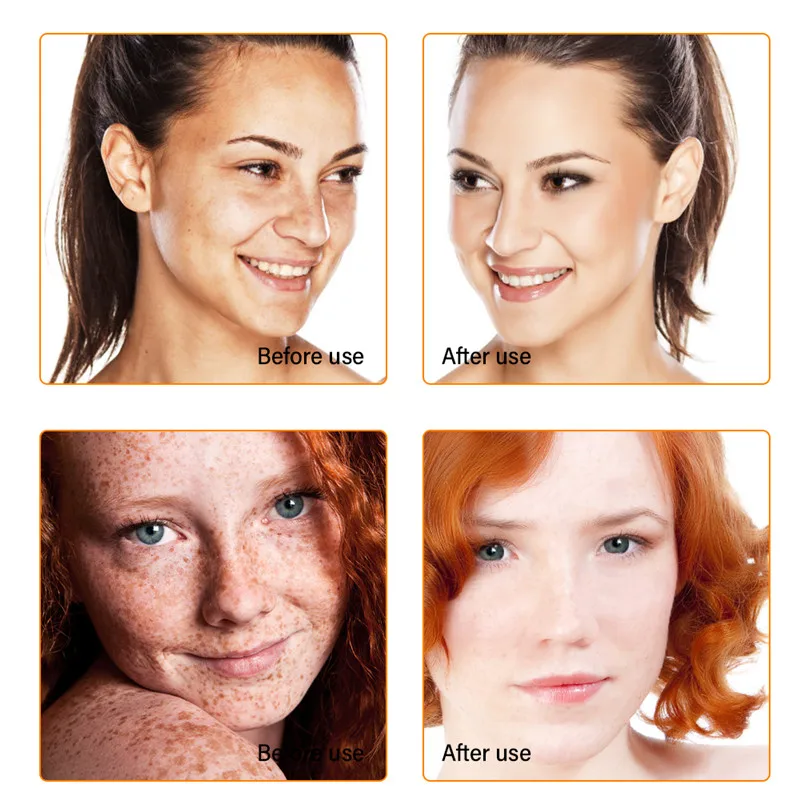 Отбеливающий крем для лица Minch морковный корректор темных пятен средство