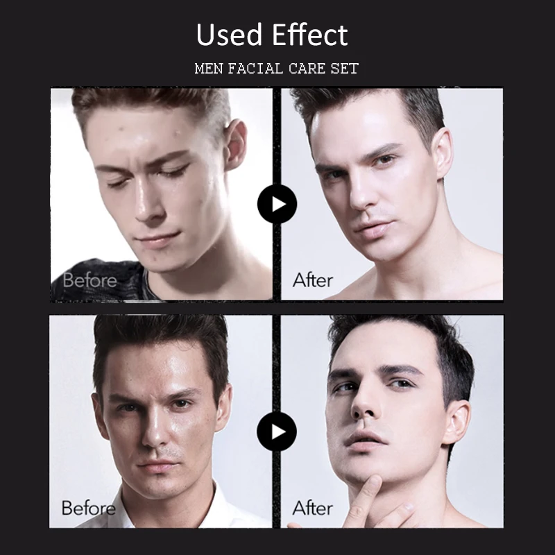 4 шт./компл. мужской Осветляющий набор для ухода за кожей очищающее средство тоник